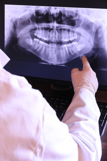 Best Emergency Gum Treatment in Carnesville, GA