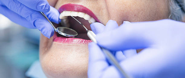 Best Emergency Wisdom Teeth Removal in Carnesville, GA